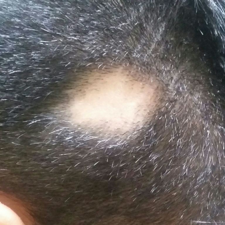 Cabelo