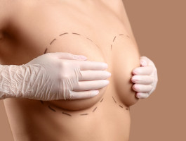 Eine Frau hält mit weißen Handschuhen einen weiblichen Körper, welcher mit schwarzen gestrichelten Linien markiert ist.