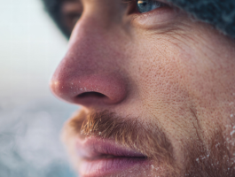 Nahaufnahme eines Mannes mit Mütze im Winter: gerötete Nase, kalte Gesichtshaut und sichtbarer Atem in frostiger Luft.