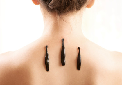 Eine Nahaufnahme des oberen Rückens einer Person mit hochgestecktem Haar. Drei Blutegel sind auf der Haut platziert, entlang der Wirbelsäule. Die Szene ist hell und gut beleuchtet.