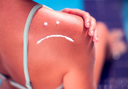 Eine Nahaufnahme einer Schulter einer Person, die einen Badeanzug trägt. Auf der Schulter ist ein trauriges Gesicht mit Sonnencreme gemalt. Die Hand der Person hält die Schulter leicht.