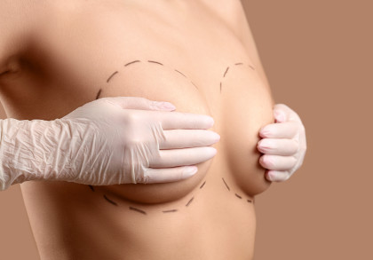 Eine Frau hält mit weißen Handschuhen einen weiblichen Körper, welcher mit schwarzen gestrichelten Linien markiert ist.