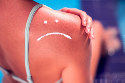 Eine Nahaufnahme einer Schulter einer Person, die einen Badeanzug trägt. Auf der Schulter ist ein trauriges Gesicht mit Sonnencreme gemalt. Die Hand der Person hält die Schulter leicht.