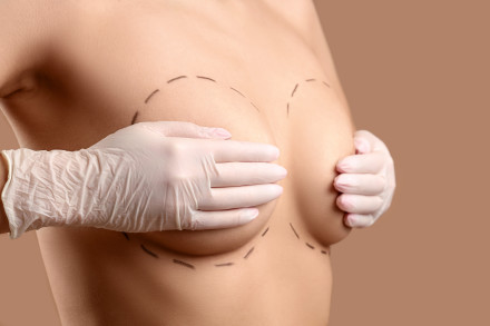 Eine Frau hält mit weißen Handschuhen einen weiblichen Körper, welcher mit schwarzen gestrichelten Linien markiert ist.