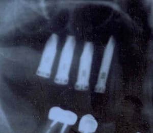 Çradios 2 pp9iwa - Eugenol