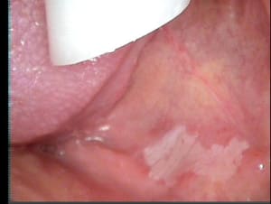 002 avkptc - Eugenol