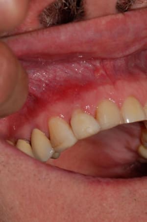 005 mnhglk - Eugenol