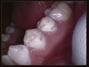 008 hz3cxl - Eugenol