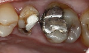 01  mg 2632 hixoh7 - Eugenol