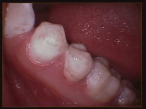 012 koihwf - Eugenol