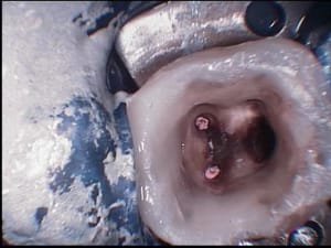 012 yywepv - Eugenol