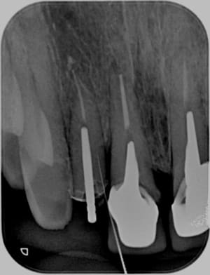 01673 x 2013 07 29 15 07 51 4 tcecl9 - Eugenol