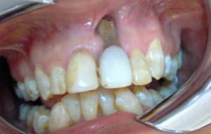 030 deih2f - Eugenol