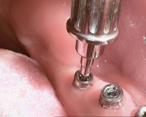 05 20120614 122451 pgnbdm - Eugenol