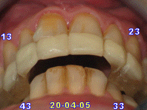 050420 rmda jxevsb - Eugenol