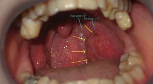 050712 dsd amygdale kxmi5w - Eugenol