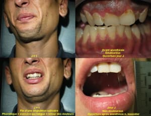 051018 tr03 mxbwja - Eugenol