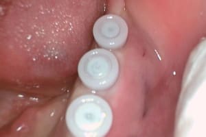06 20120324 120924 aegm4n - Eugenol