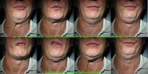 07 déglutition salivaire xfkrij - Eugenol