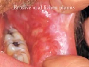 0 s88u68 - Eugenol