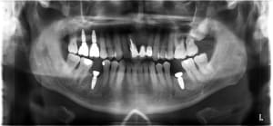 0ruvqba5x4ygjcmtaxrk21ftwnod - Eugenol