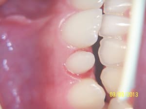 100 1318 prfwsc - Eugenol