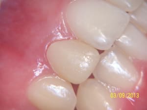 100 1320 pgromp - Eugenol