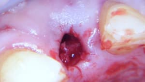 100 2423 x4s9rb - Eugenol