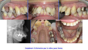 10343 b hkjfjg - Eugenol