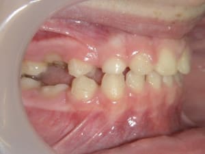 10705 06 09 15 08940 tfexfp - Eugenol