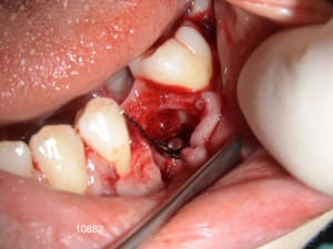 10882 2bis uzjlw0 - Eugenol