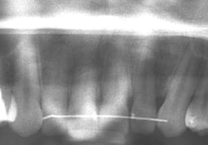 11 12 21 22 e61vvb - Eugenol