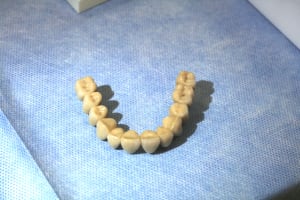 11 bridge1 dkj3ei - Eugenol