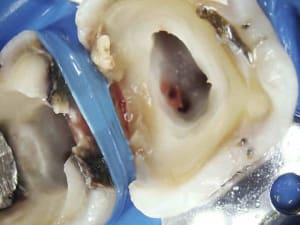 11 v9ty2p - Eugenol