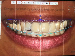 12f11ff4 a4f3 4150 bcc8 7258cfadcf35 d1csrx - Eugenol