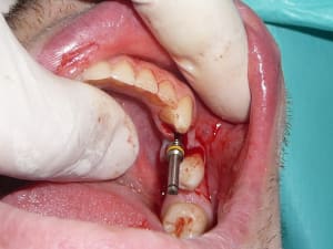 12 mavokz - Eugenol