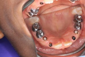 14 avril2010 001  small  l0qiyt - Eugenol