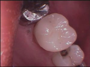 16 réalisation vue face triturante hpqyvj - Eugenol