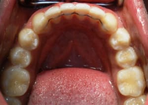 17 06 09  dep  5 n2pucx - Eugenol