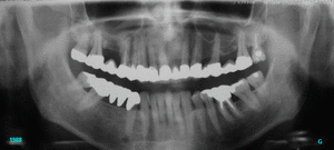 1984 1988 wibdom - Eugenol