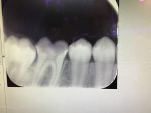 1caf1cd3 45e5 449e b052 143917f06211 qjys3k - Eugenol