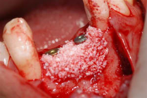 2007 06 23 012 jsfsaw - Eugenol