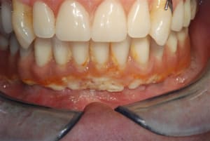 2009 03 16 013 ryt0v7 - Eugenol