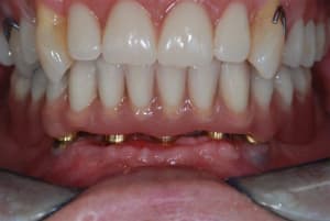 2009 07 12 002 xdyvfh - Eugenol