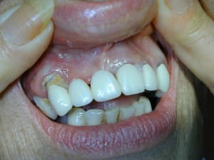 2009 11 20 5 yjhjfs - Eugenol