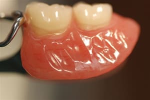 2009 11 26 019 xniv5t - Eugenol