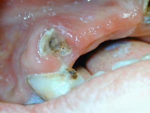 2009 11 26 1 gehx2h - Eugenol