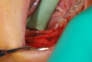 2010 04 22 012 s6wj7x - Eugenol