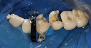 2010 04 22 0177rw fwf7uc - Eugenol