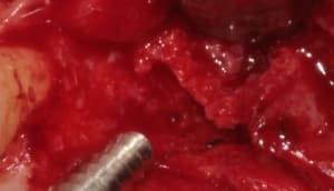 2010 05 28 0388 ragicb - Eugenol
